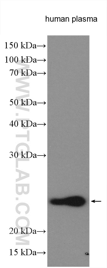 Western Blot (WB) analysis of various lysates using HRP-conjugated Human IgG Kappa chain Monoclonal an (HRP-67761)