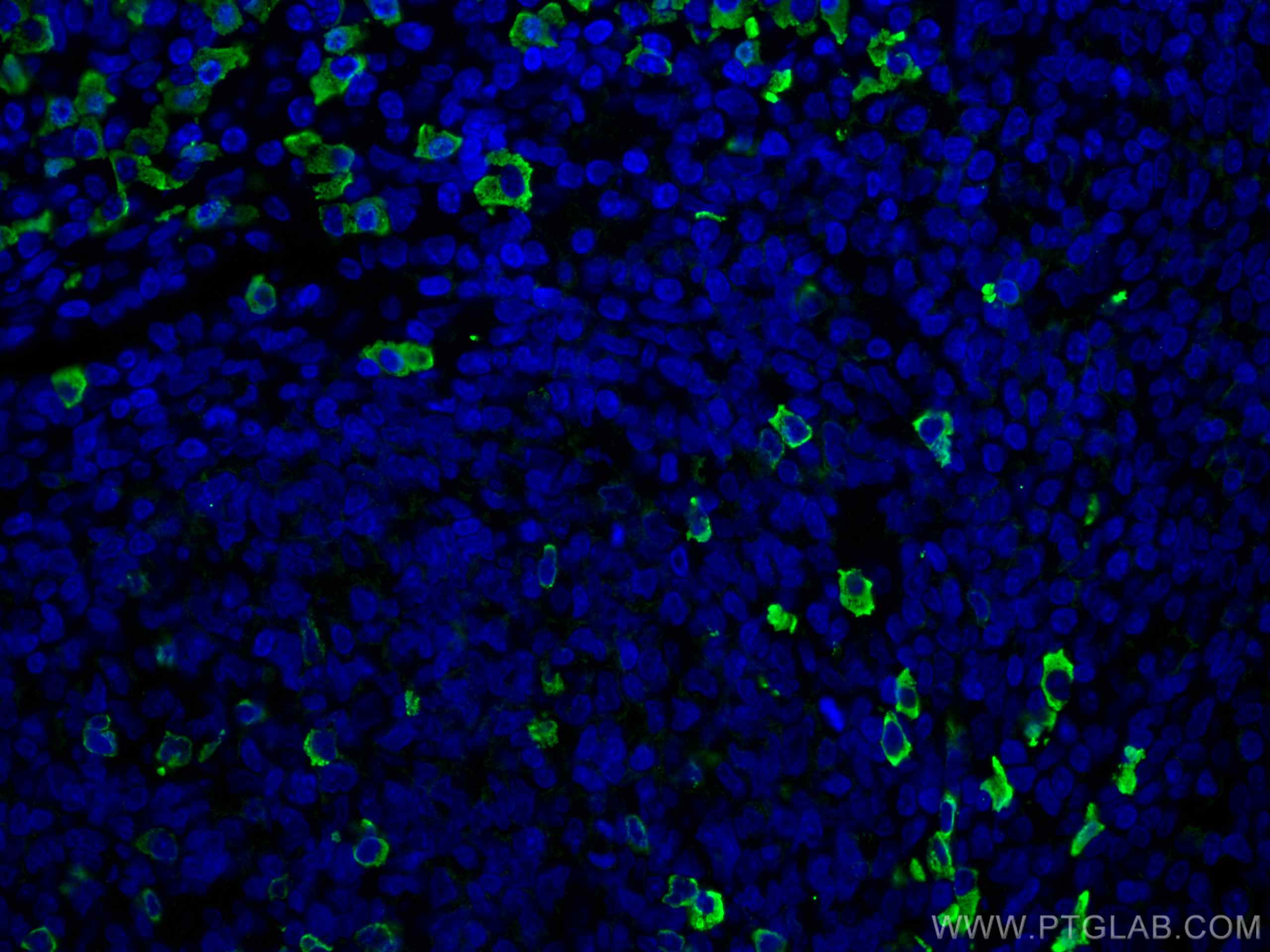 Immunofluorescence (IF) / fluorescent staining of human tonsillitis tissue using Human IgG lambda chain Monoclonal antibody (67762-1-Ig)