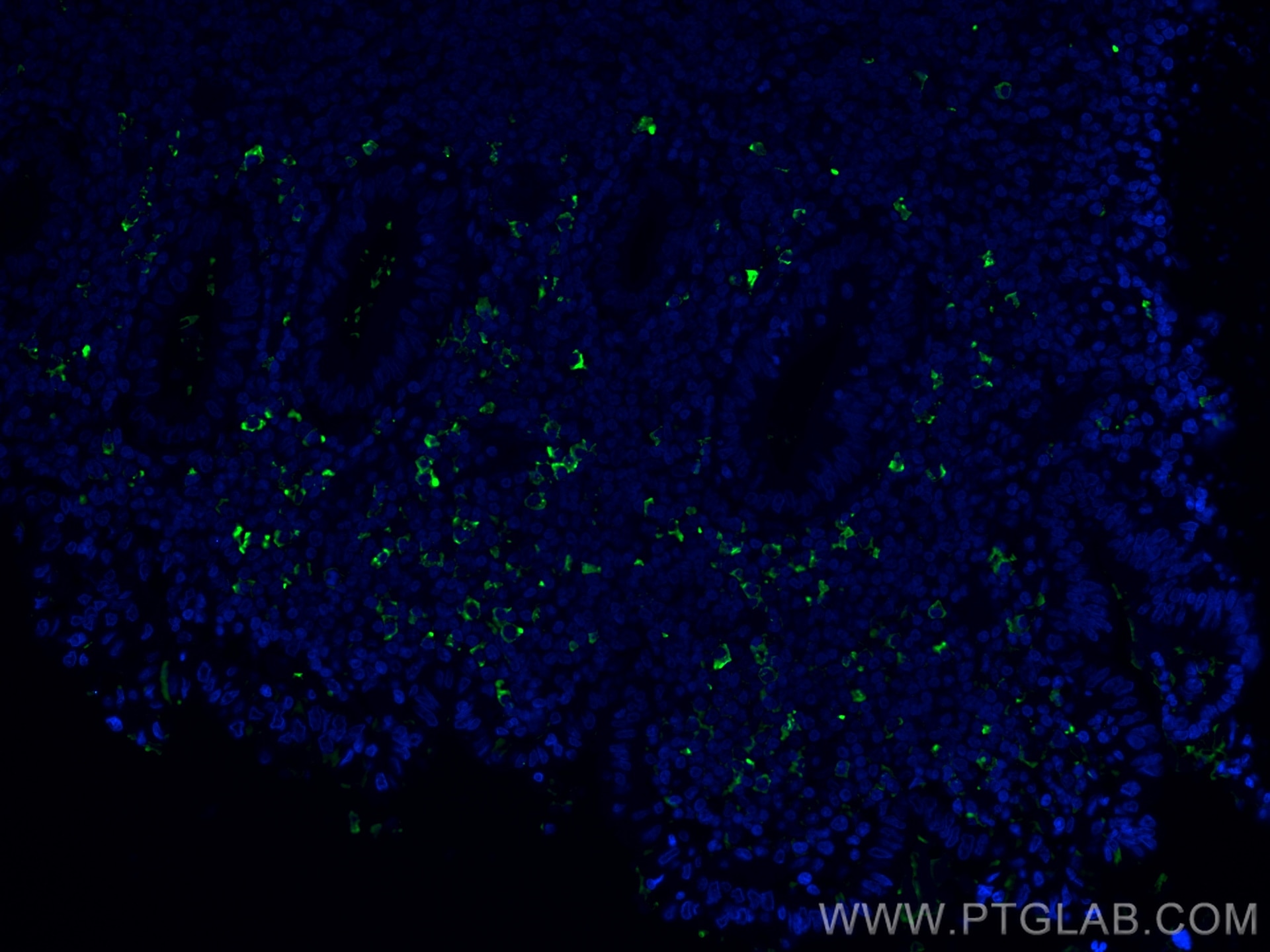 Immunofluorescence (IF) / fluorescent staining of human appendicitis tissue using Human IgG lambda chain Monoclonal antibody (67762-1-Ig)