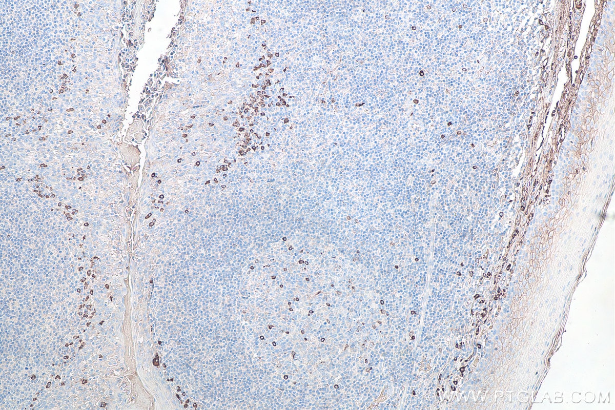Immunohistochemistry (IHC) staining of human tonsillitis tissue using Human IgG lambda chain Monoclonal antibody (67762-1-Ig)