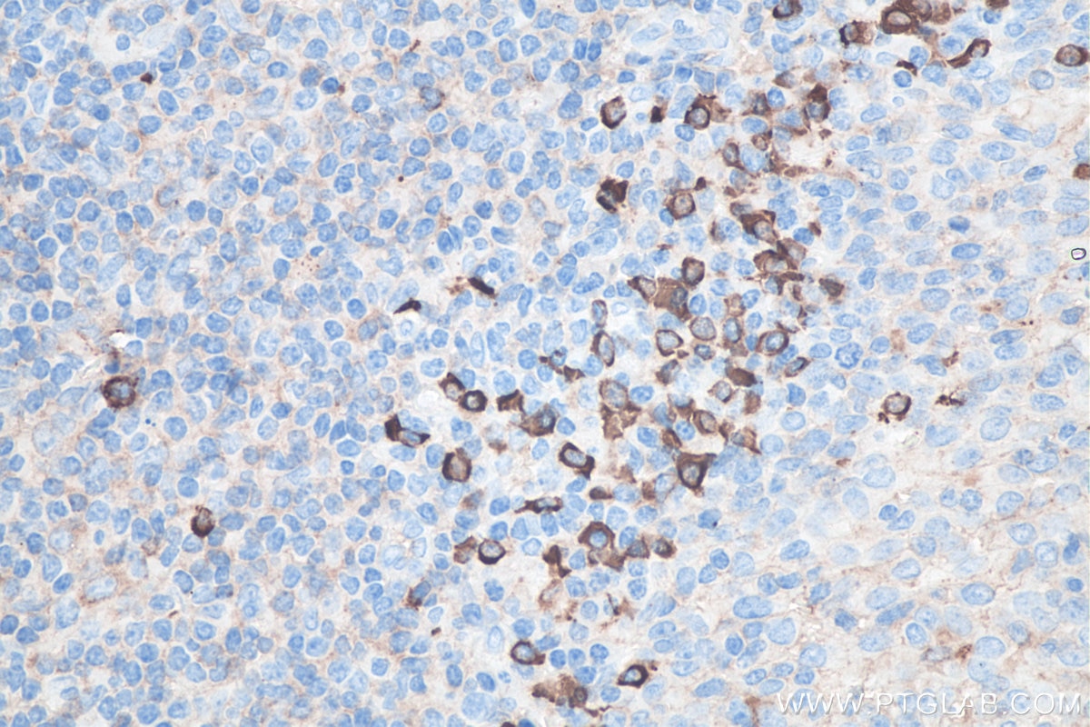 Immunohistochemistry (IHC) staining of human tonsillitis tissue using Human IgG lambda chain Monoclonal antibody (67762-1-Ig)