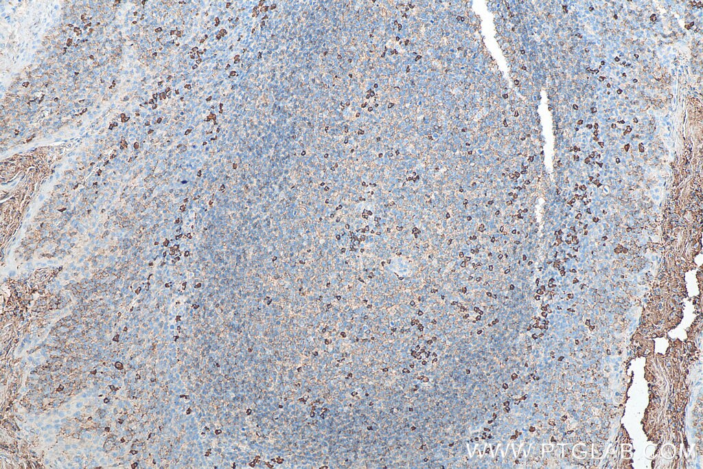 Immunohistochemistry (IHC) staining of human tonsillitis tissue using Biotin-conjugated Human IgG lambda chain Monoclona (Biotin-67762)