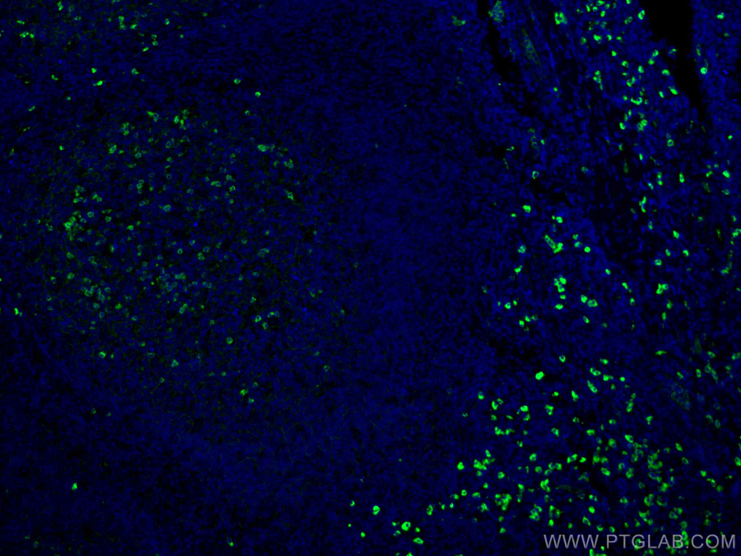 Immunofluorescence (IF) / fluorescent staining of human tonsillitis tissue using CoraLite® Plus 488-conjugated Human IgG lambda cha (CL488-67762)