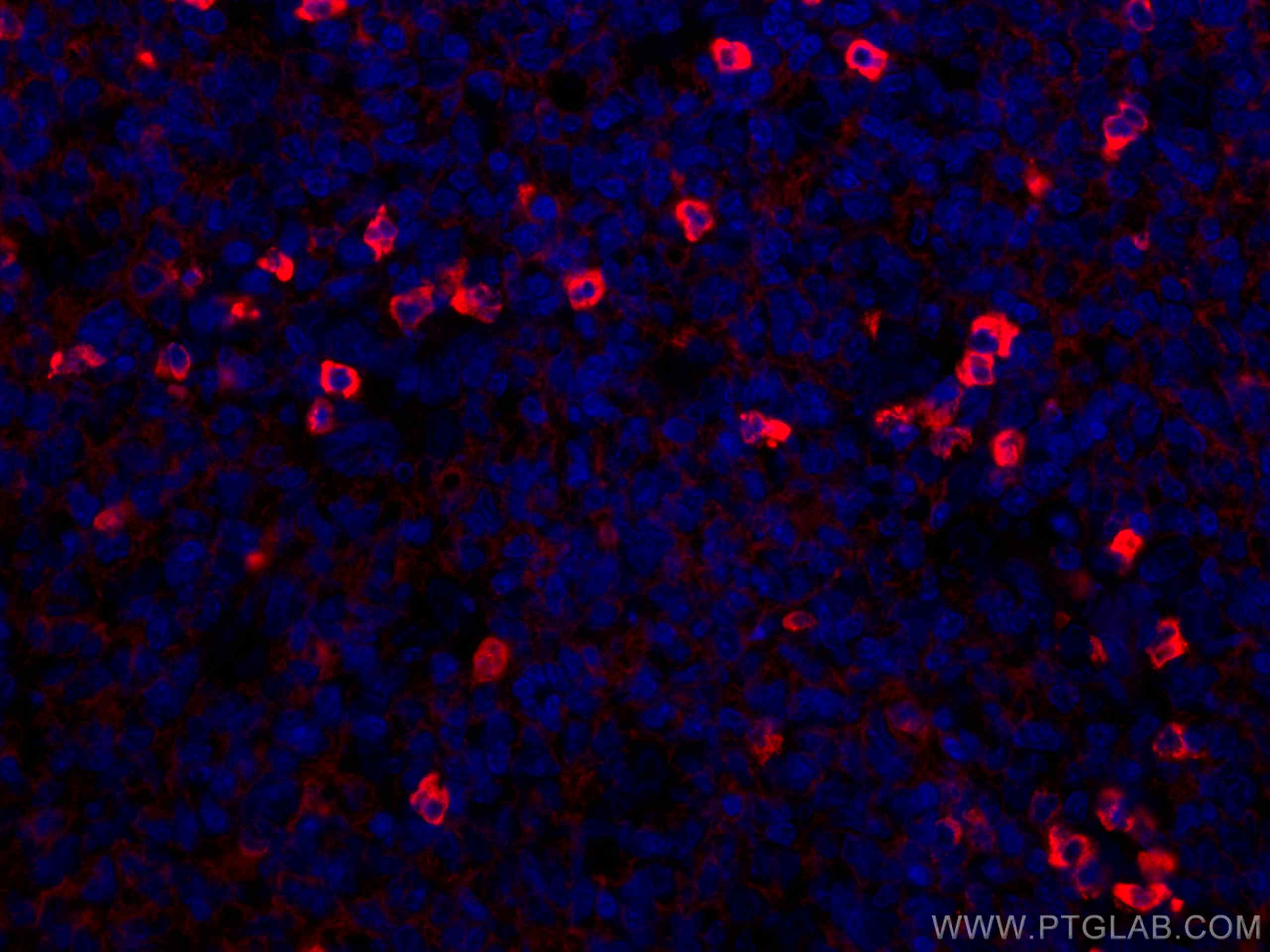 Immunofluorescence (IF) / fluorescent staining of human tonsillitis tissue using CoraLite®594-conjugated Human IgG lambda chain Mon (CL594-67762)