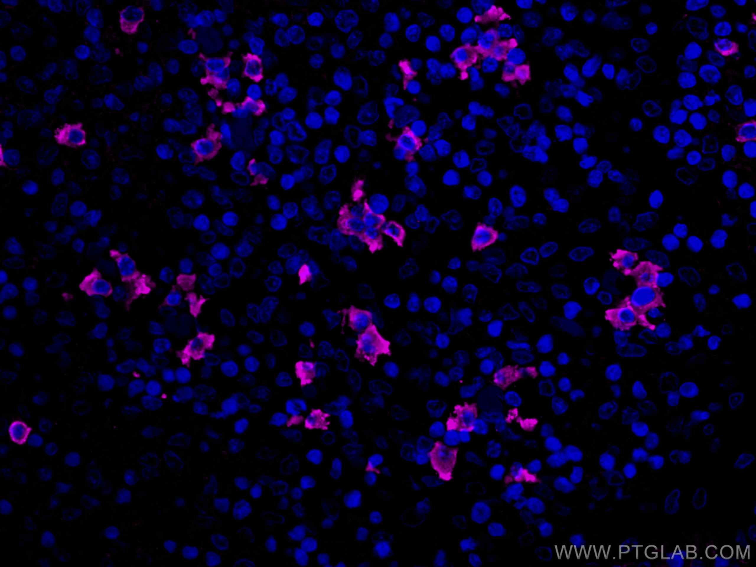 Immunofluorescence (IF) / fluorescent staining of human tonsillitis tissue using CoraLite® Plus 647-conjugated Human IgG lambda cha (CL647-67762)