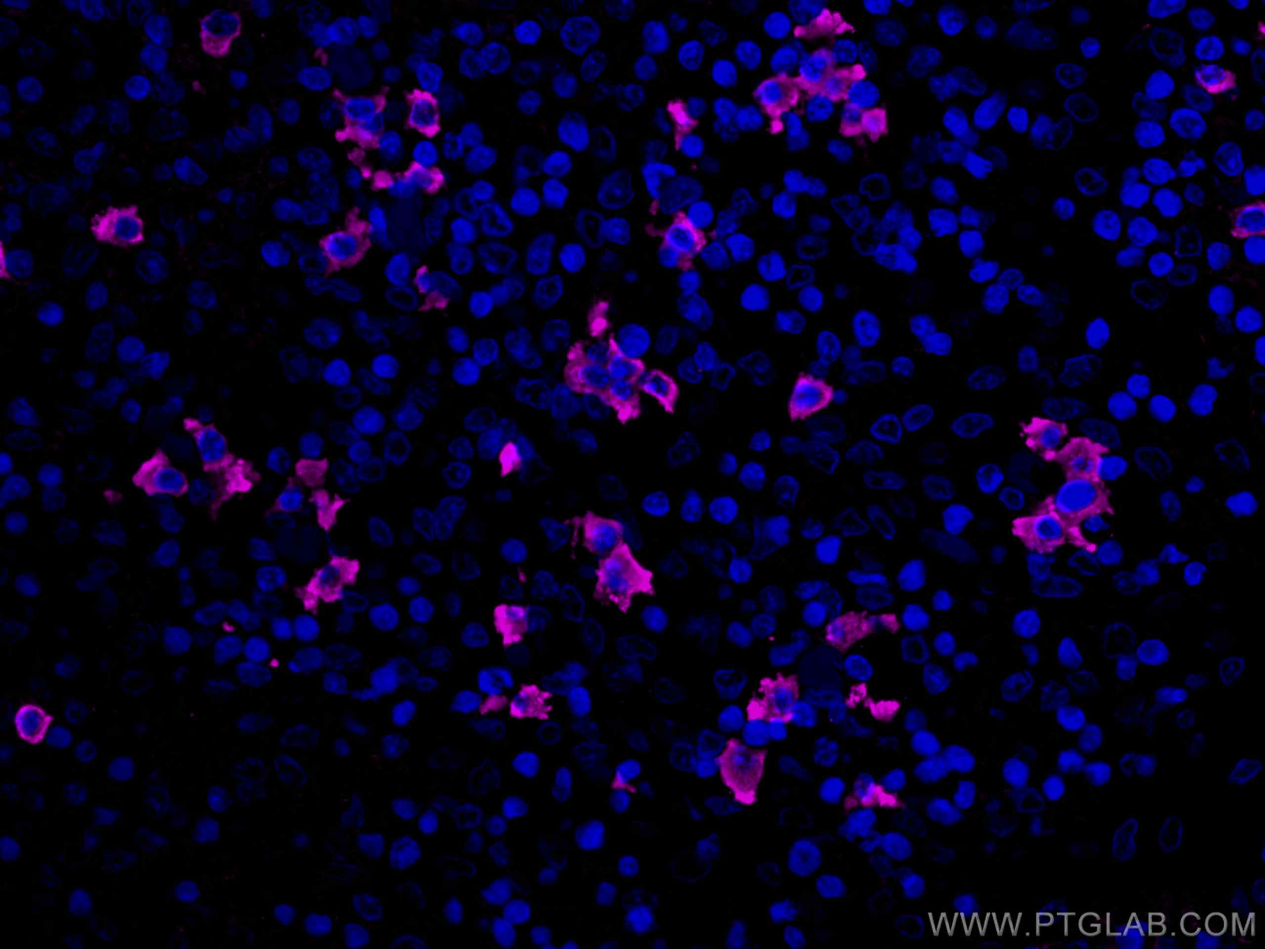 IF Staining of human tonsillitis using CL647-67762