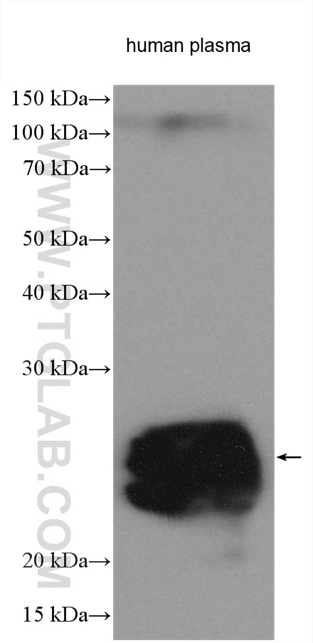 Western Blot (WB) analysis of various lysates using HRP-conjugated Human IgG lambda chain Monoclonal a (HRP-67762)