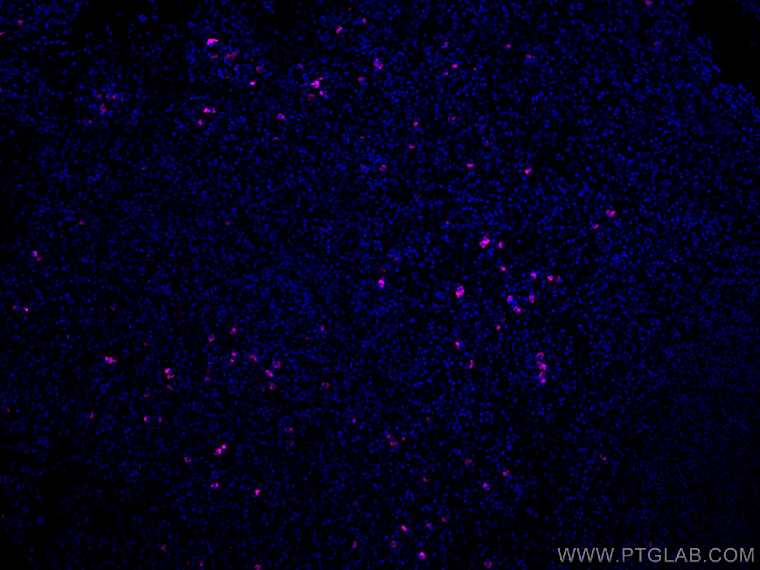 Immunofluorescence (IF) / fluorescent staining of human tonsillitis tissue using CoraLite® Plus 647-conjugated Human IgG4 Monoclona (CL647-66408)