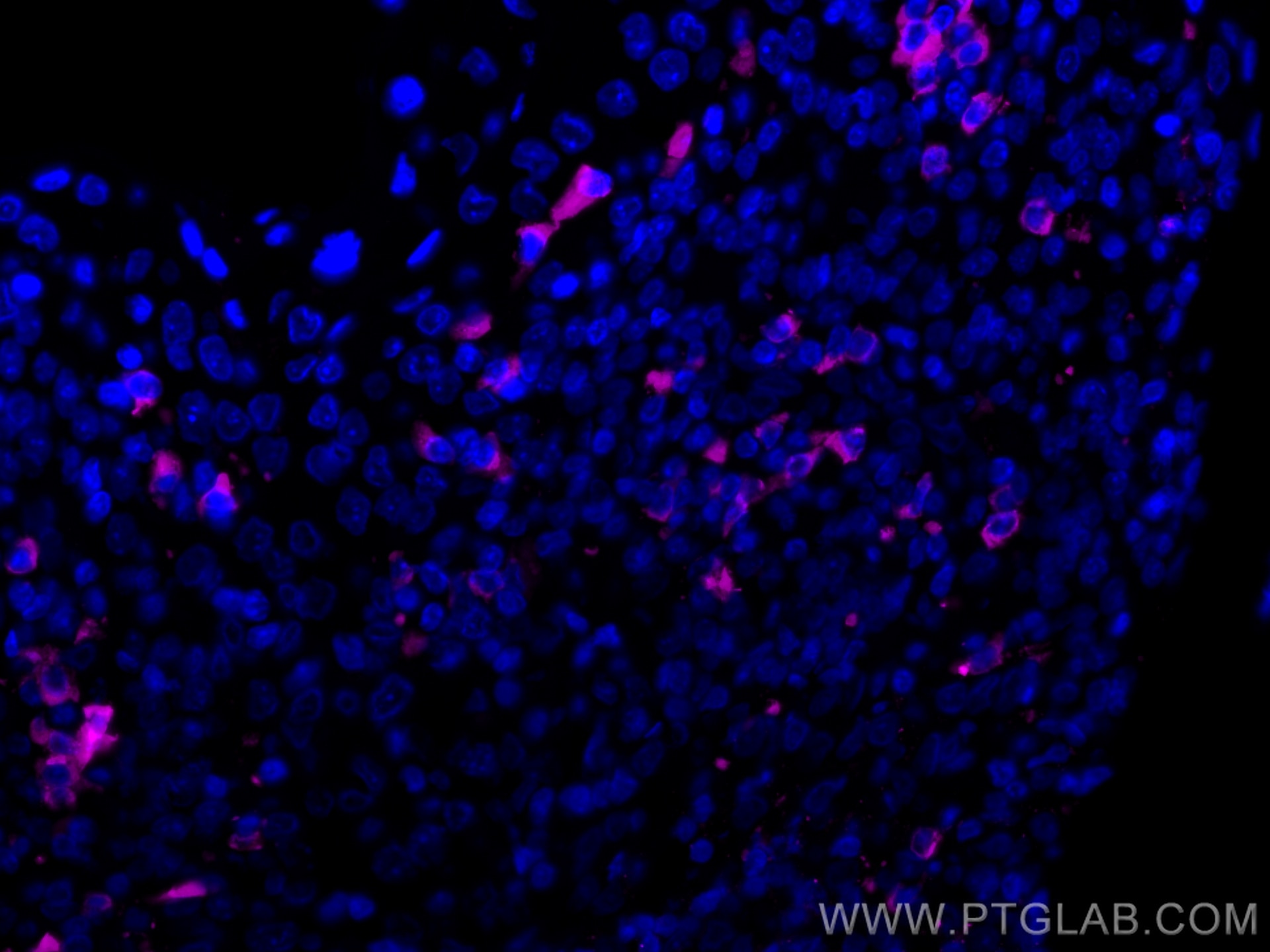 Immunofluorescence (IF) / fluorescent staining of human tonsillitis tissue using CoraLite®647-conjugated Human IgG4 Monoclonal anti (CL647-66408)