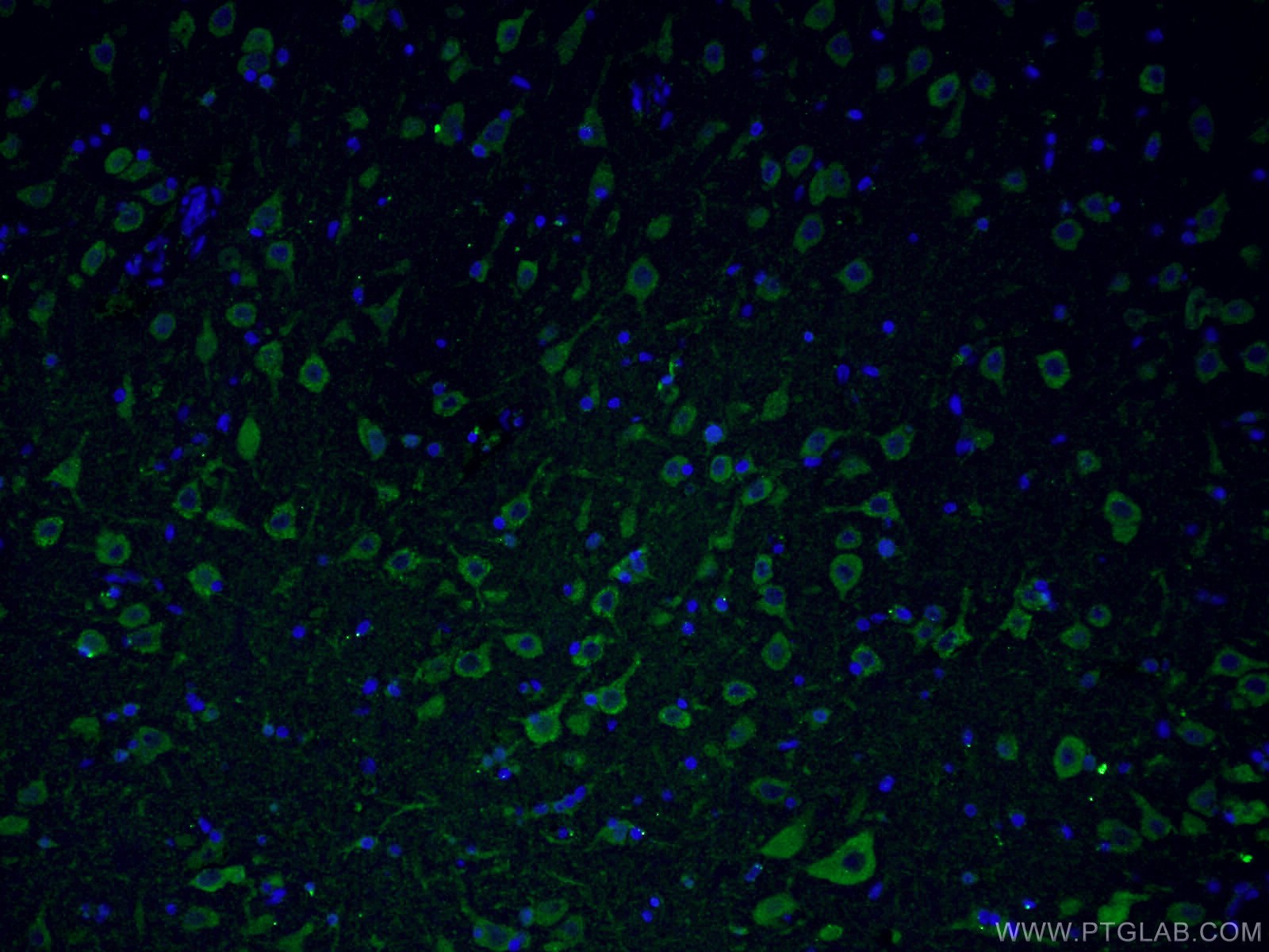 Immunofluorescence (IF) / fluorescent staining of human brain tissue using Huntingtin Polyclonal antibody (27206-1-AP)