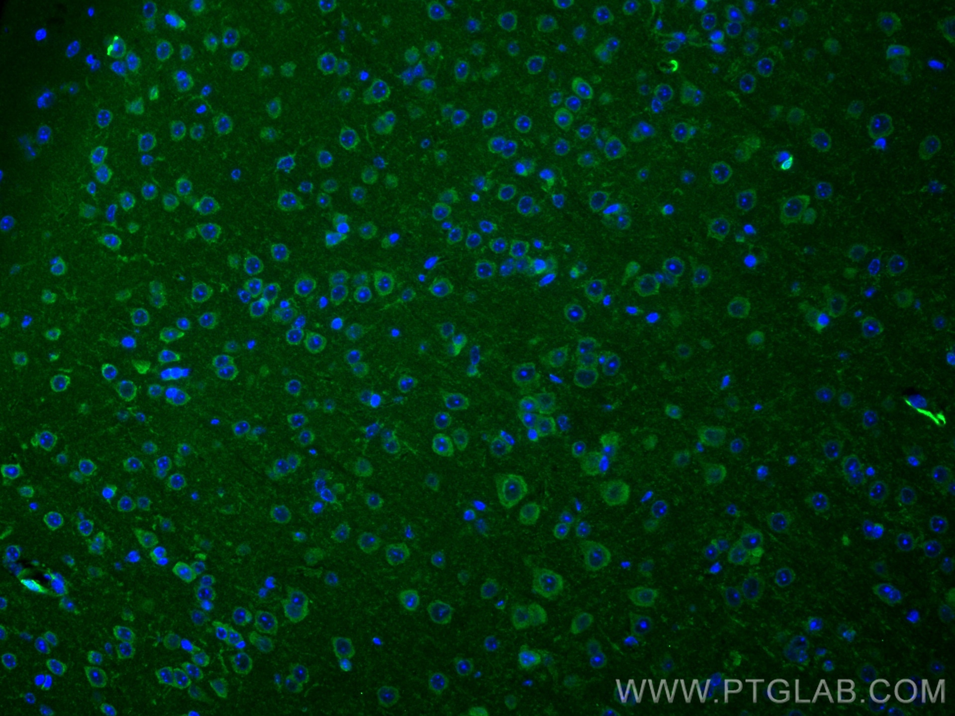 Immunofluorescence (IF) / fluorescent staining of mouse brain tissue using Huntingtin Polyclonal antibody (27206-1-AP)