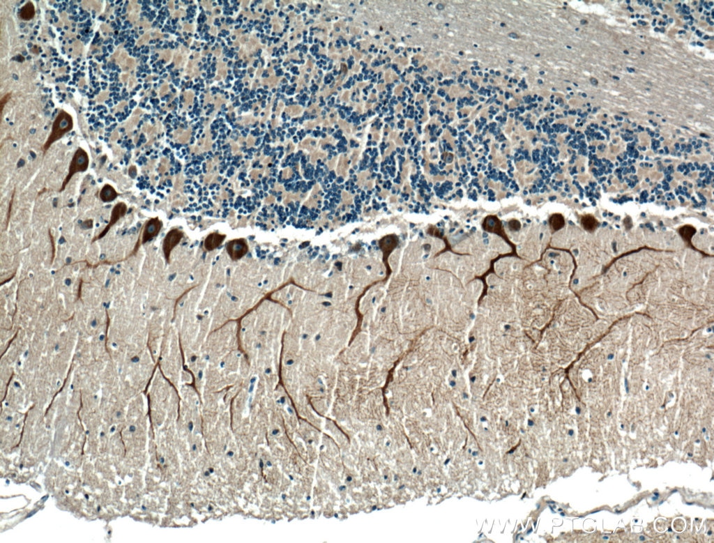 IHC staining of human cerebellum using 27206-1-AP
