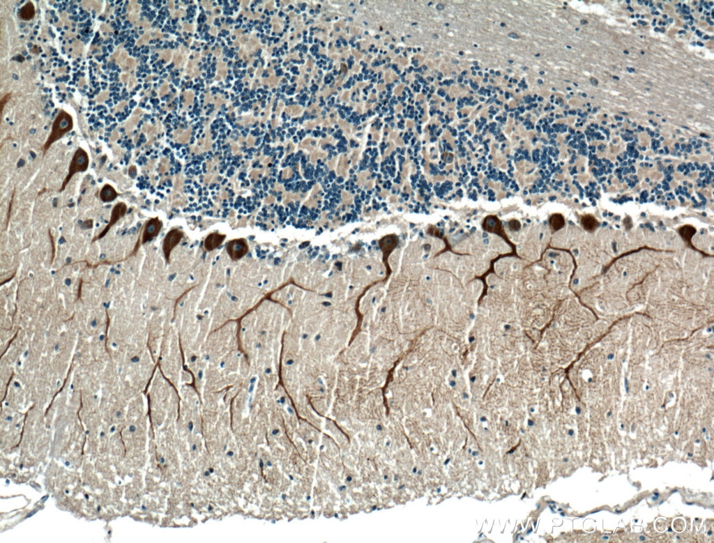 Immunohistochemistry (IHC) staining of human cerebellum tissue using Huntingtin Polyclonal antibody (27206-1-AP)