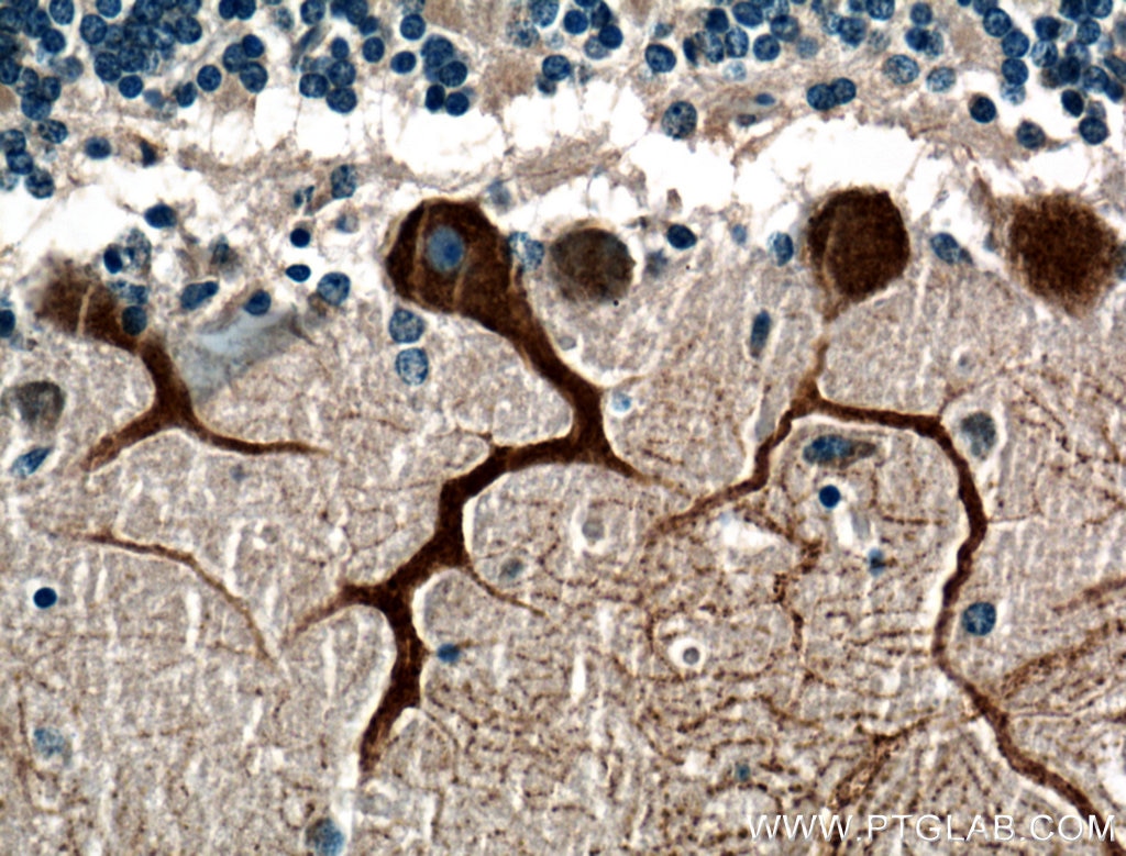 Immunohistochemistry (IHC) staining of human cerebellum tissue using Huntingtin Polyclonal antibody (27206-1-AP)