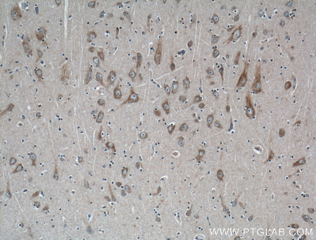 Immunohistochemistry (IHC) staining of human brain tissue using Huntingtin Polyclonal antibody (27206-1-AP)