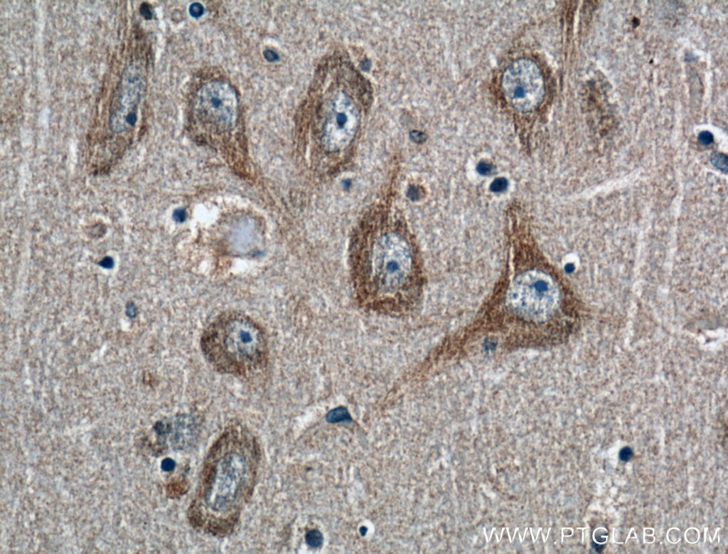 Immunohistochemistry (IHC) staining of human brain tissue using Huntingtin Polyclonal antibody (27206-1-AP)