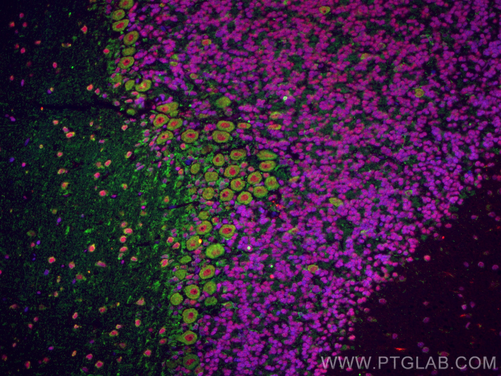 Immunofluorescence (IF) / fluorescent staining of rat cerebellum tissue using Huntingtin Monoclonal antibody (66553-1-Ig)