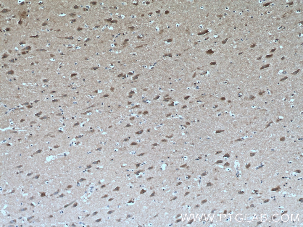 Immunohistochemistry (IHC) staining of human brain tissue using Huntingtin Monoclonal antibody (66553-1-Ig)