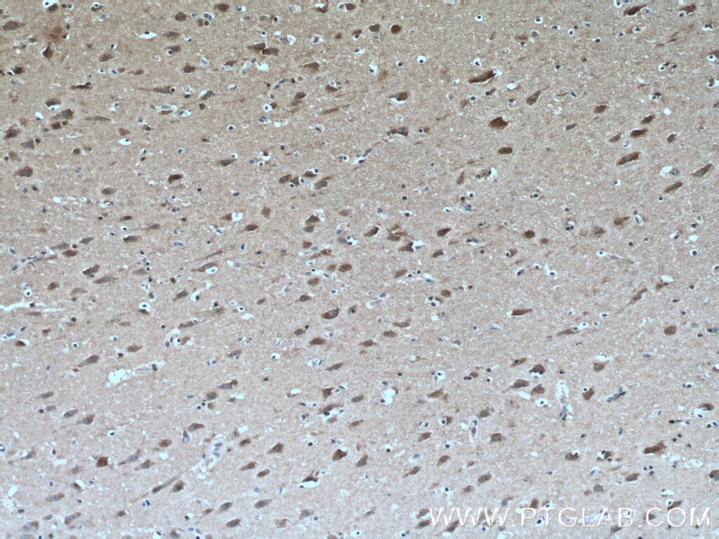 IHC staining of human brain using 66553-1-Ig