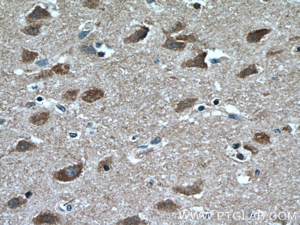 Immunohistochemistry (IHC) staining of human brain tissue using Huntingtin Monoclonal antibody (66553-1-Ig)