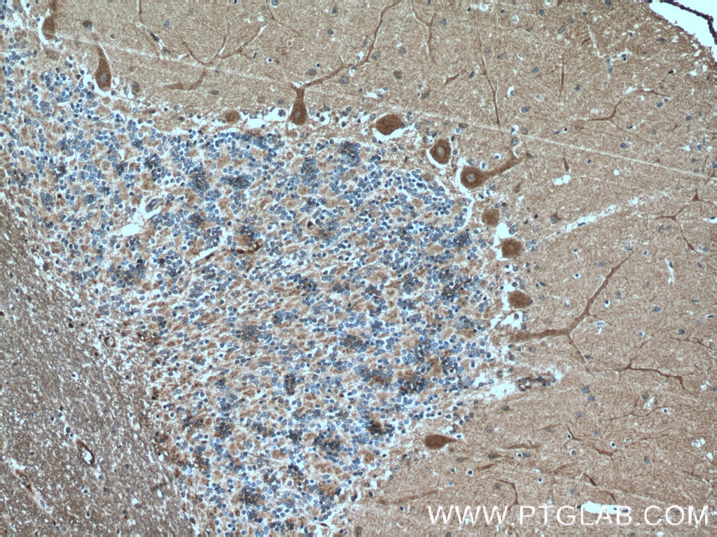 Immunohistochemistry (IHC) staining of human cerebellum tissue using Huntingtin Monoclonal antibody (66553-1-Ig)