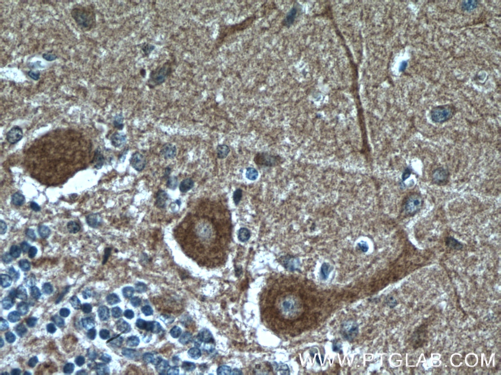 Immunohistochemistry (IHC) staining of human cerebellum tissue using Huntingtin Monoclonal antibody (66553-1-Ig)