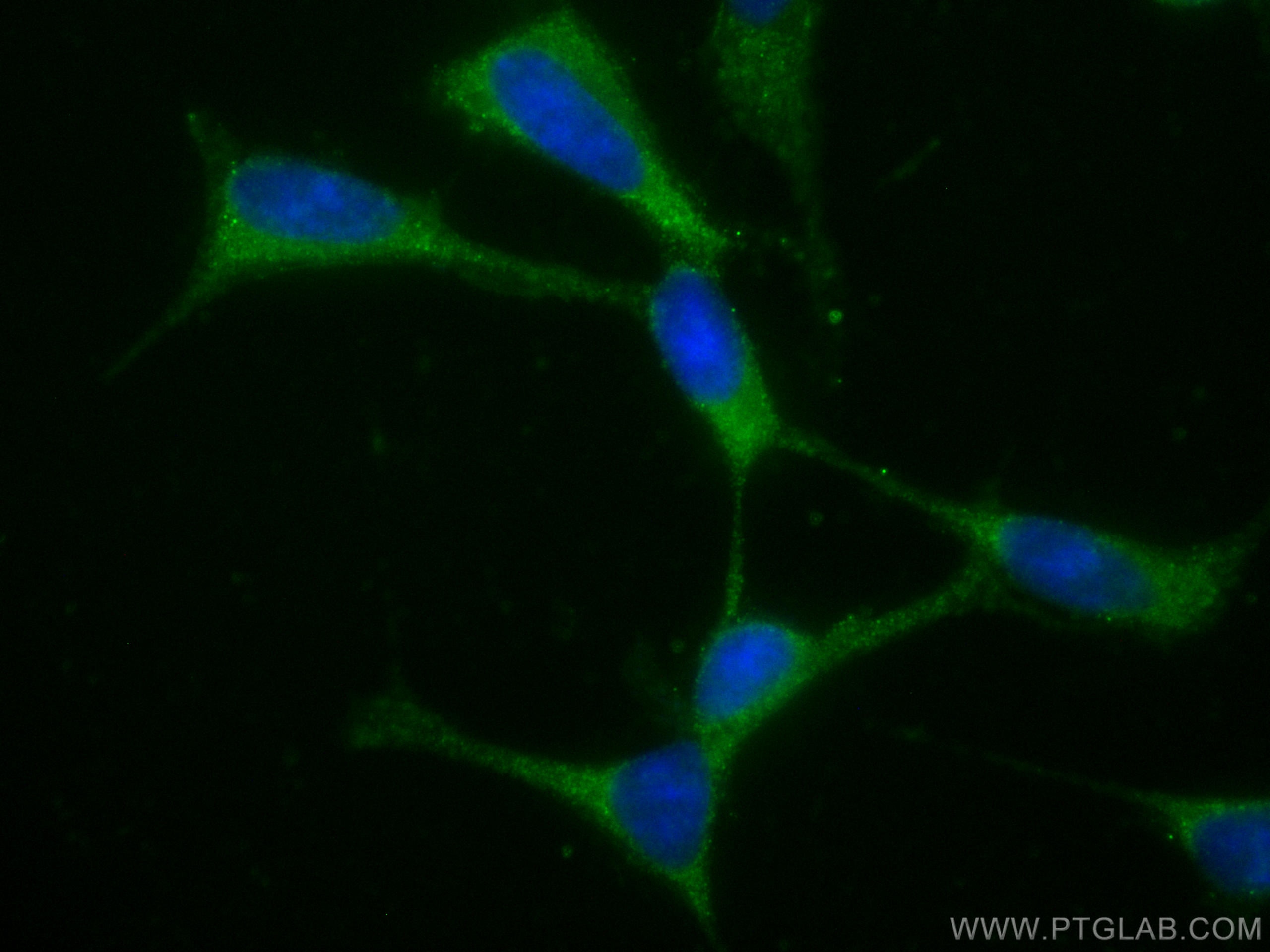 Immunofluorescence (IF) / fluorescent staining of SH-SY5Y cells using CoraLite® Plus 488-conjugated Huntingtin Polyclona (CL488-27206)