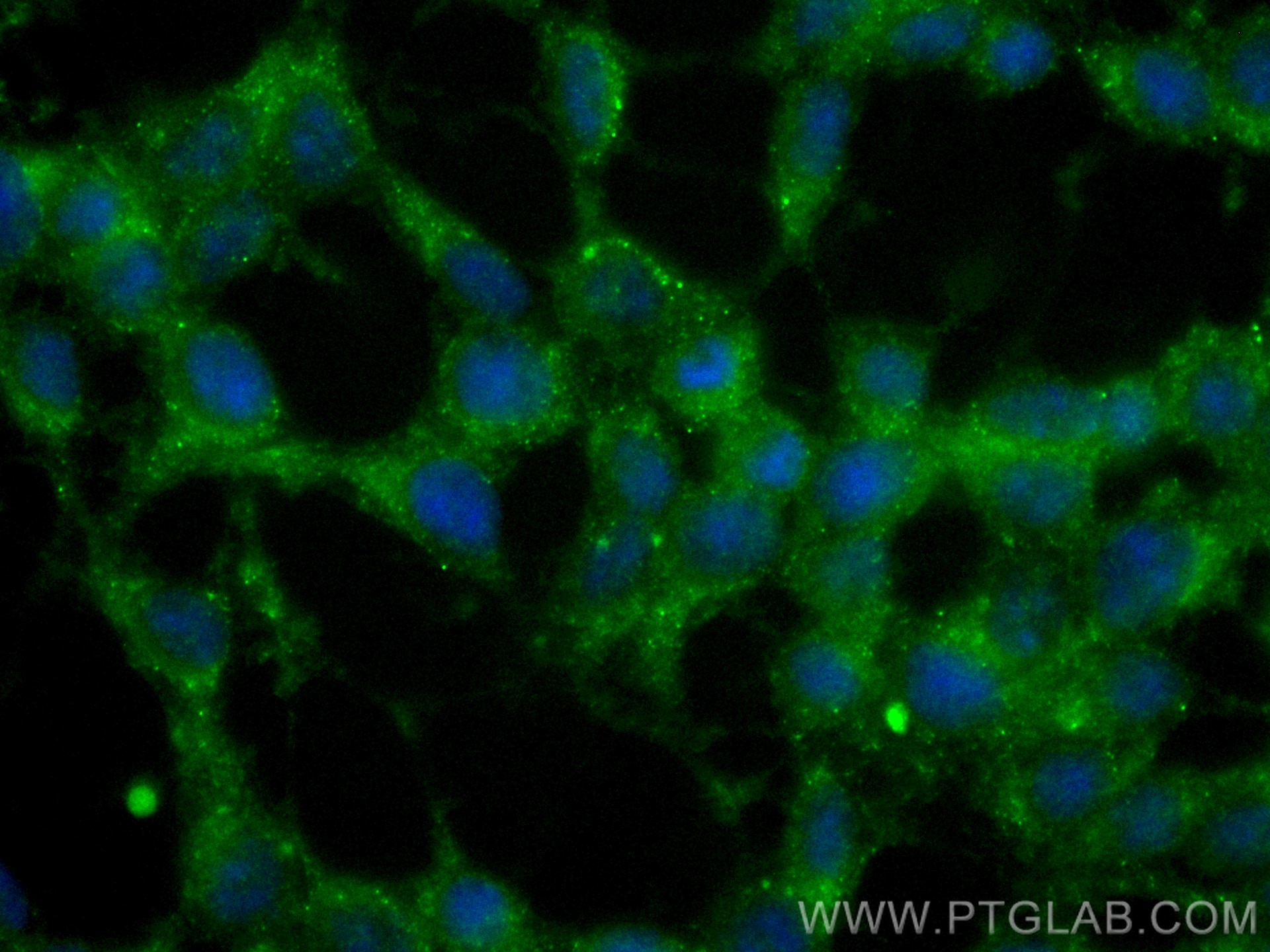 Immunofluorescence (IF) / fluorescent staining of SH-SY5Y cells using CoraLite® Plus 488-conjugated Huntingtin Monoclona (CL488-66553)