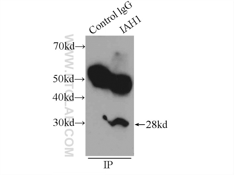 Immunoprecipitation (IP) experiment of mouse testis tissue using IAH1 Polyclonal antibody (17808-1-AP)