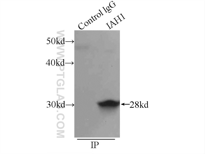 Immunoprecipitation (IP) experiment of mouse kidney tissue using IAH1 Polyclonal antibody (17808-1-AP)