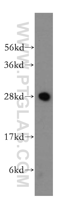 Western Blot (WB) analysis of mouse testis tissue using IAH1 Polyclonal antibody (17808-1-AP)