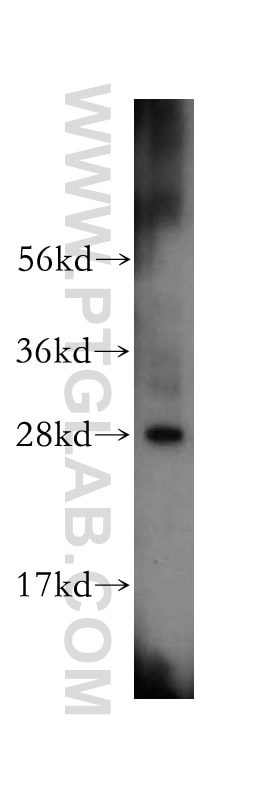 Western Blot (WB) analysis of mouse brain tissue using IAH1 Polyclonal antibody (17808-1-AP)