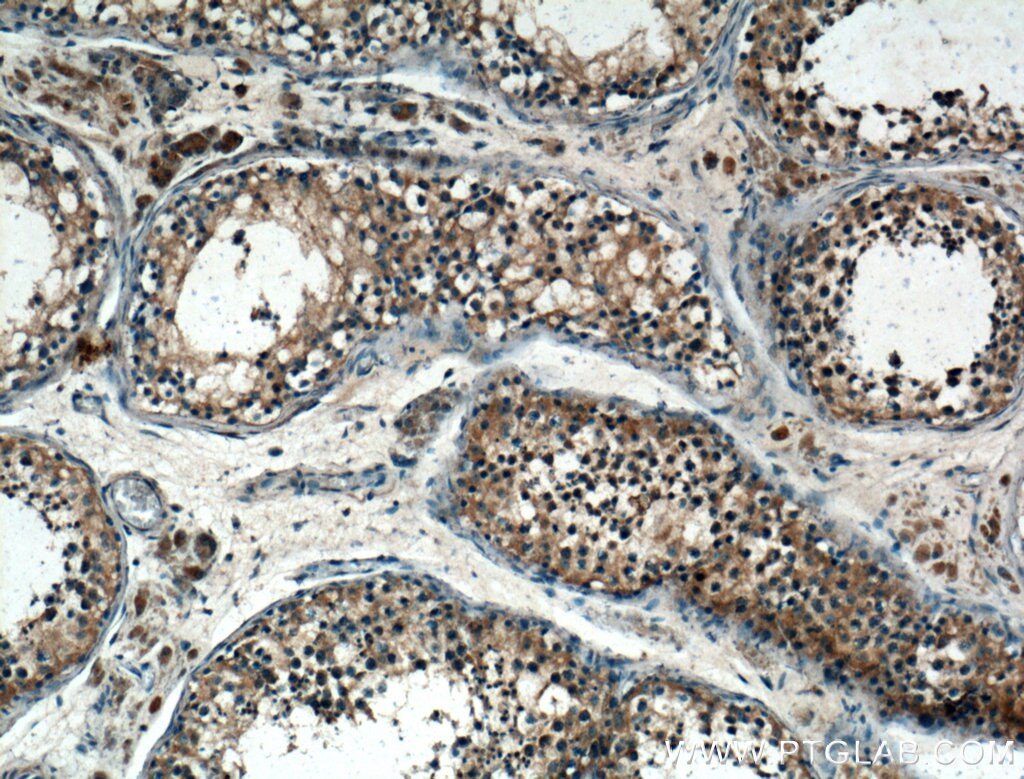Immunohistochemistry (IHC) staining of human testis tissue using IARS Polyclonal antibody (26942-1-AP)