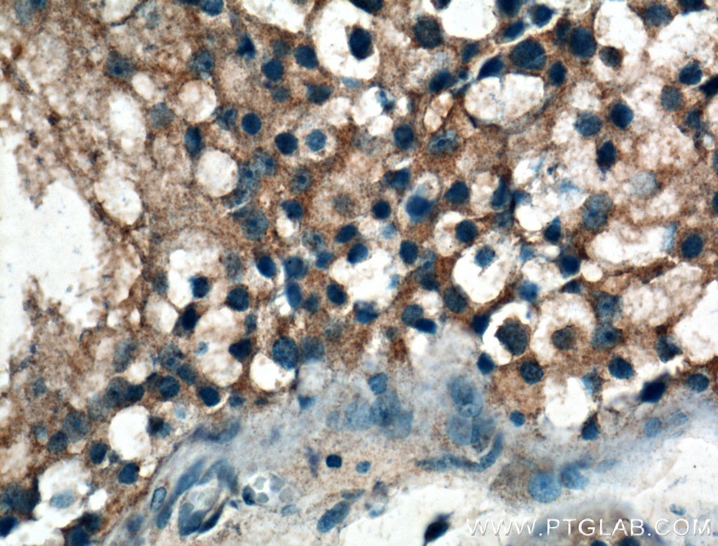 Immunohistochemistry (IHC) staining of human testis tissue using IARS Polyclonal antibody (26942-1-AP)