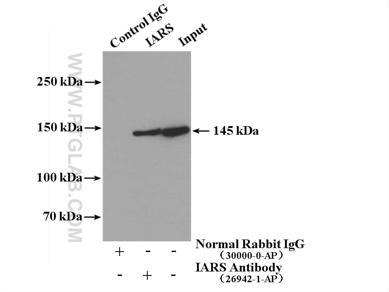 Immunoprecipitation (IP) experiment of U2OS cells using IARS Polyclonal antibody (26942-1-AP)