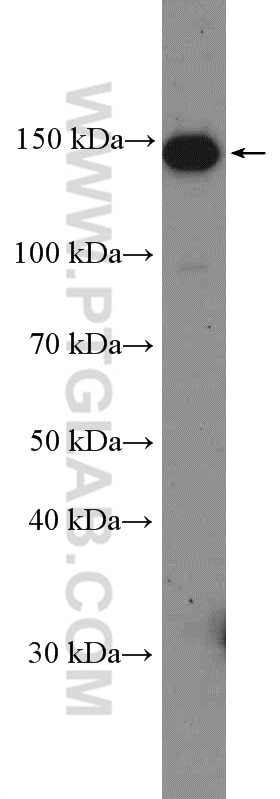 Western Blot (WB) analysis of U2OS cells using IARS Polyclonal antibody (26942-1-AP)