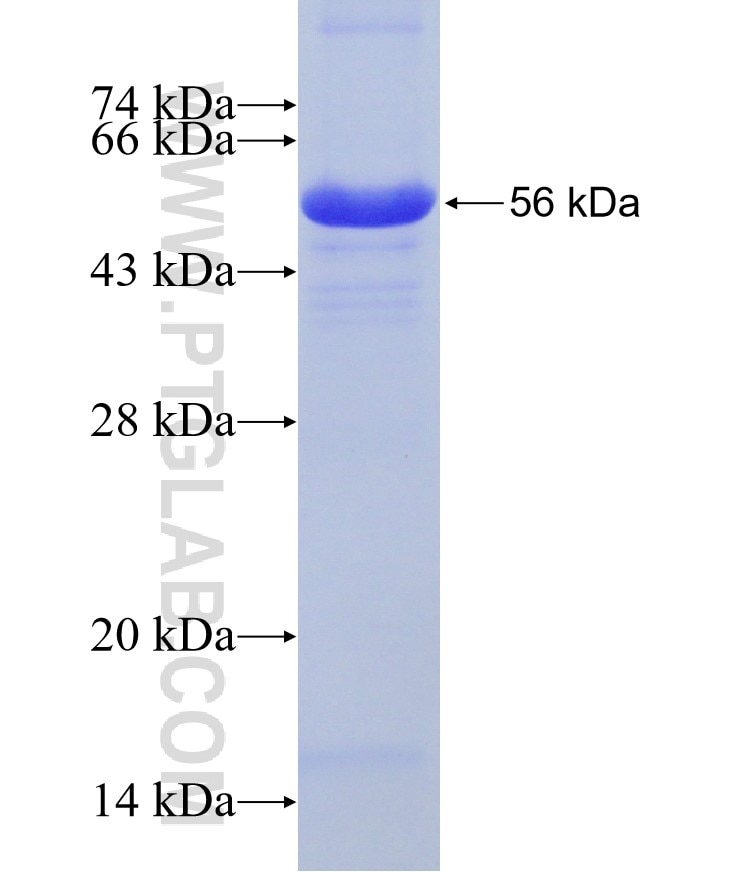 IARS fusion protein Ag25686 SDS-PAGE