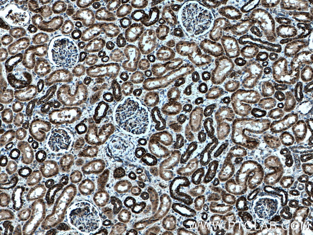 Immunohistochemistry (IHC) staining of human kidney tissue using IARS2 Polyclonal antibody (17170-1-AP)