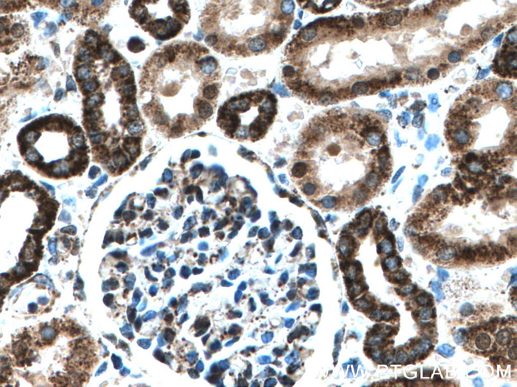 Immunohistochemistry (IHC) staining of human kidney tissue using IARS2 Polyclonal antibody (17170-1-AP)