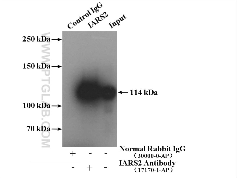 Immunoprecipitation (IP) experiment of HeLa cells using IARS2 Polyclonal antibody (17170-1-AP)