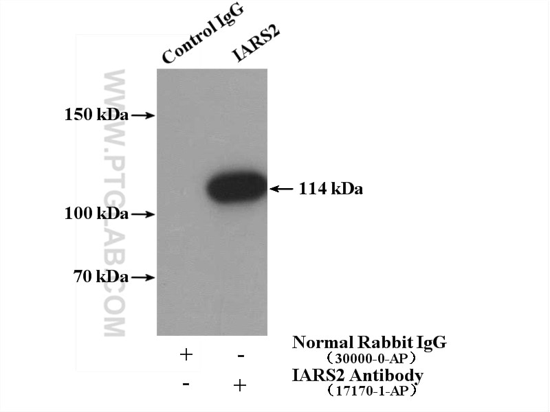 Immunoprecipitation (IP) experiment of Jurkat cells using IARS2 Polyclonal antibody (17170-1-AP)
