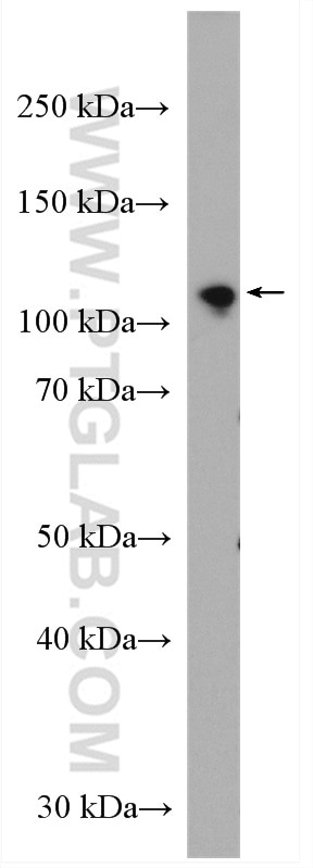 Western Blot (WB) analysis of mouse brain tissue using IARS2 Polyclonal antibody (17170-1-AP)