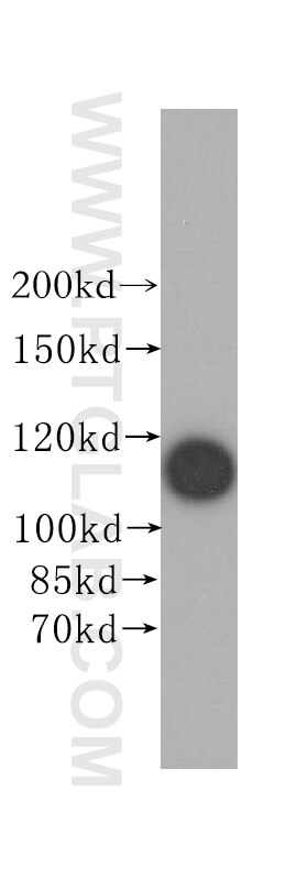 IARS2 Polyclonal antibody