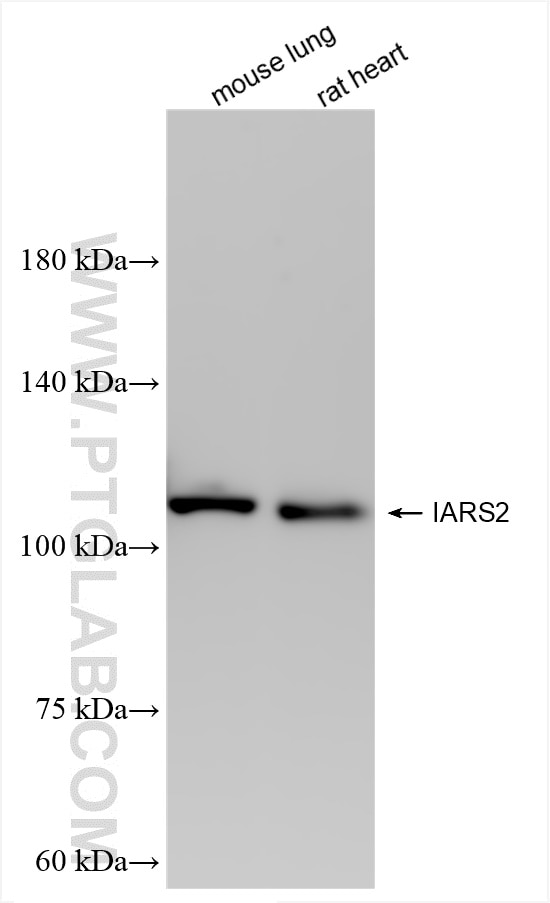 Western Blot (WB) analysis of various lysates using IARS2 Recombinant antibody (84764-3-RR)
