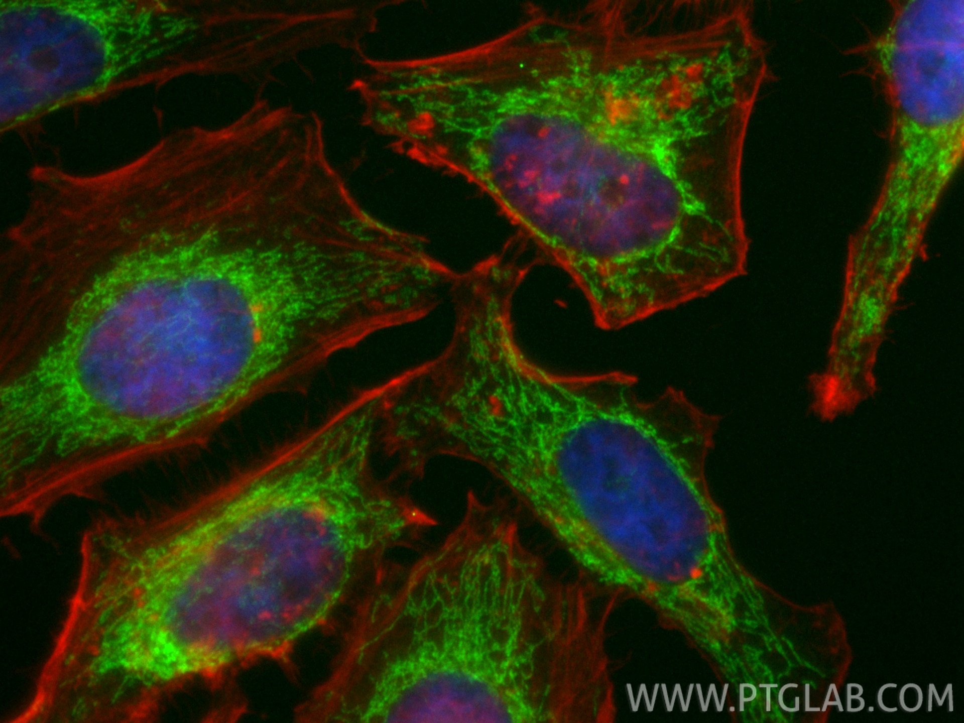 Immunofluorescent analysis of (4% PFA) fixed HeLa cells using CoraLite® Plus 488 IARS2 antibody (CL488-84764-5, Clone: 242219G4 ) at dilution of 1:200, CL594-phalloidin (red). Immunofluorescence (IF) / fluorescent staining of HeLa cells using CoraLite® Plus 488-conjugated IARS2 Recombinant mo (CL488-84764-5)