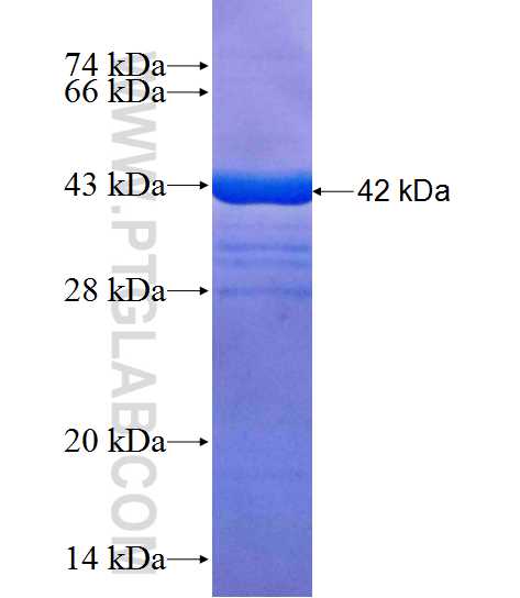 IARS2 fusion protein Ag10726 SDS-PAGE