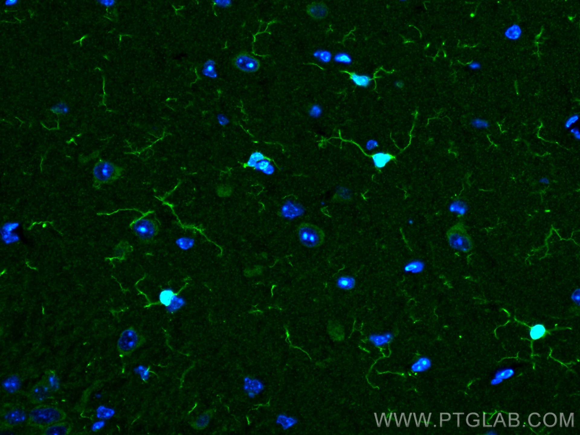 Immunofluorescence (IF) / fluorescent staining of mouse brain tissue using IBA1 Polyclonal antibody (10904-1-AP)