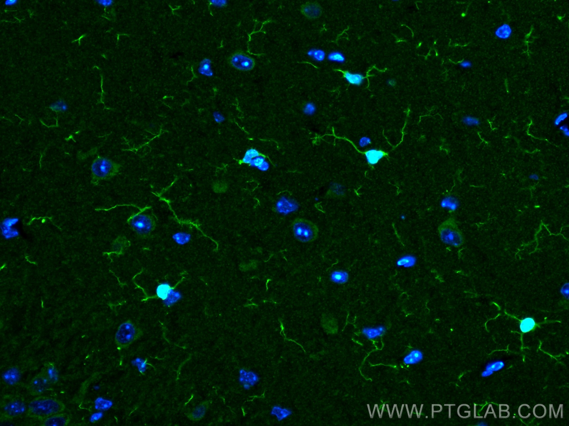 IF Staining of mouse brain using 10904-1-AP