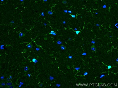 IBA1抗体を使用した4%PFA固定マウス脳組織の免疫蛍光染色