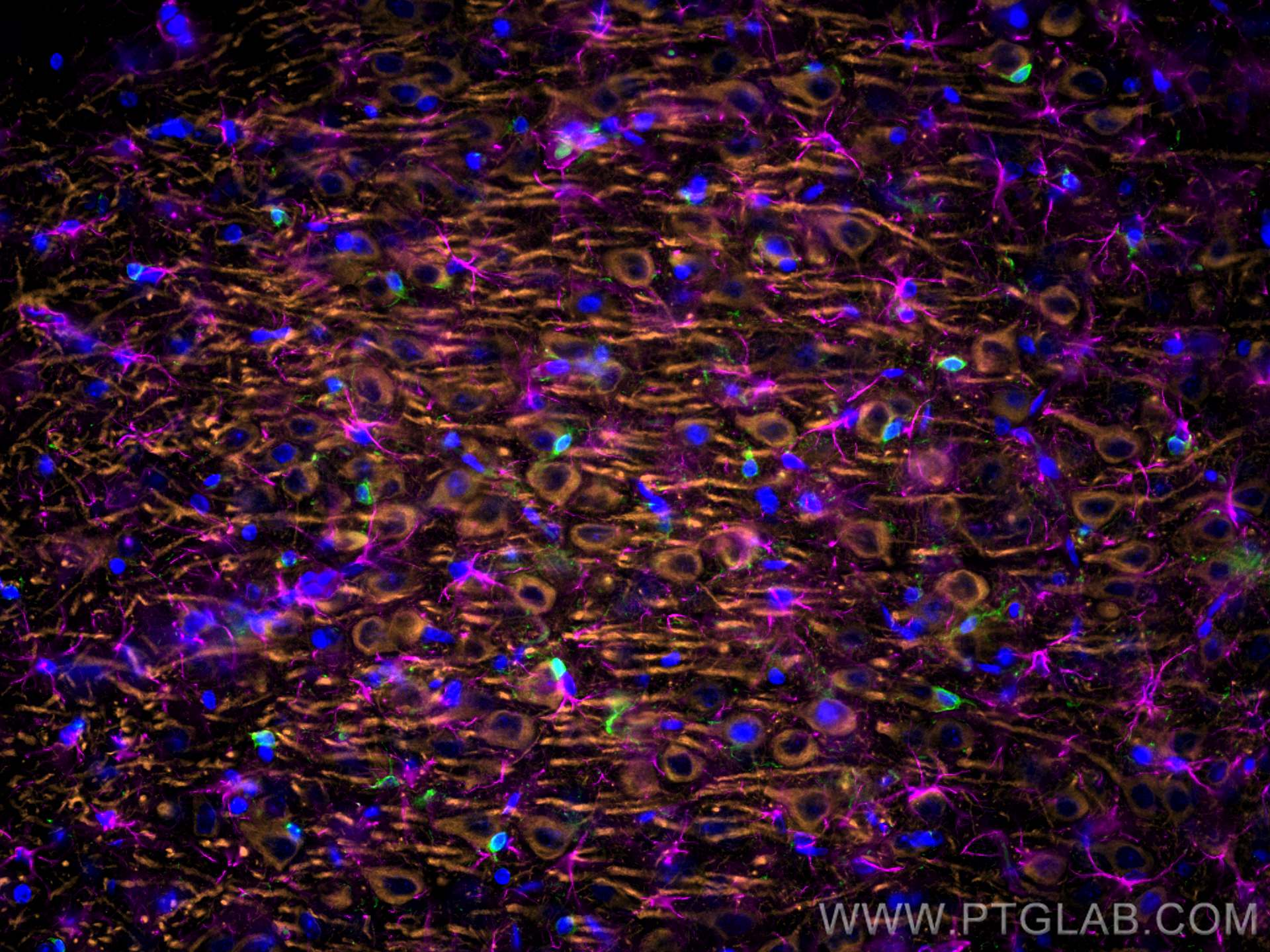 Immunofluorescence (IF) / fluorescent staining of rat brain tissue using IBA1 Polyclonal antibody (10904-1-AP)